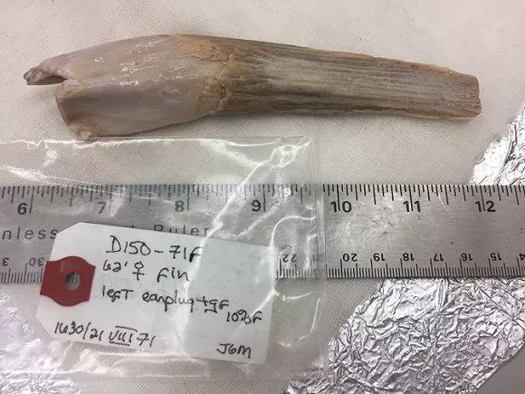 听力下降前耳垢会变成这种颜色！