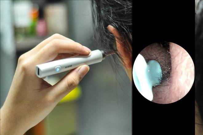 带摄像头的挖耳勺好用吗?挖耳勺到底怎么选?十大品牌测评分享!(图10)