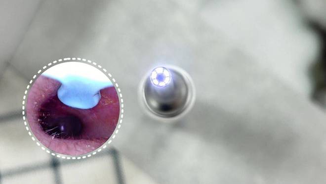 掏耳勺摄像头好用吗?盘点全网销量前十带摄像头的掏耳勺评测(图3)