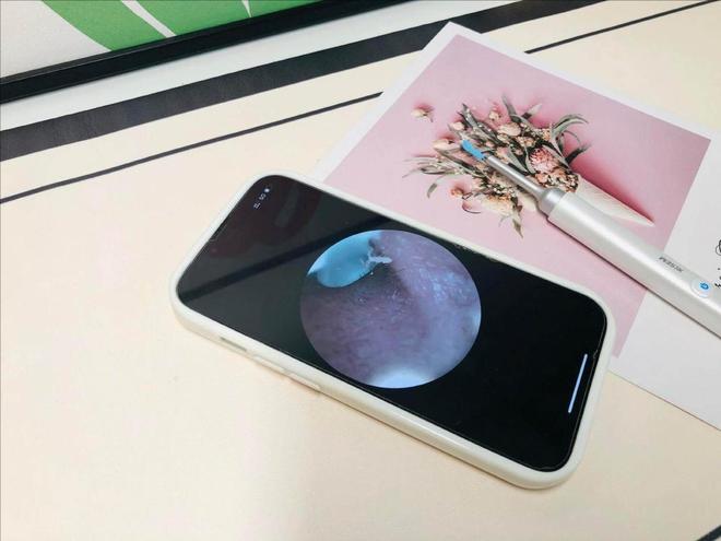 可视掏耳勺怎么选更加实用?不妨看看品牌排行榜前十名!(图7)