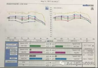 2026年无线耳机行业市场现状分析及未来趋势预测