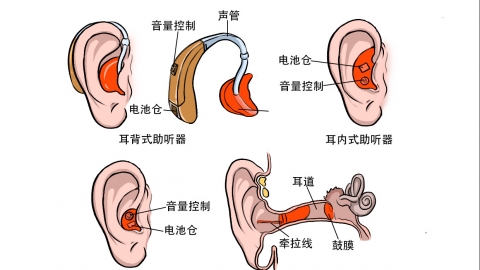vivo取得耳机组件专利能够解决无法对出音嘴网布上的耳垢进行清洁问题
